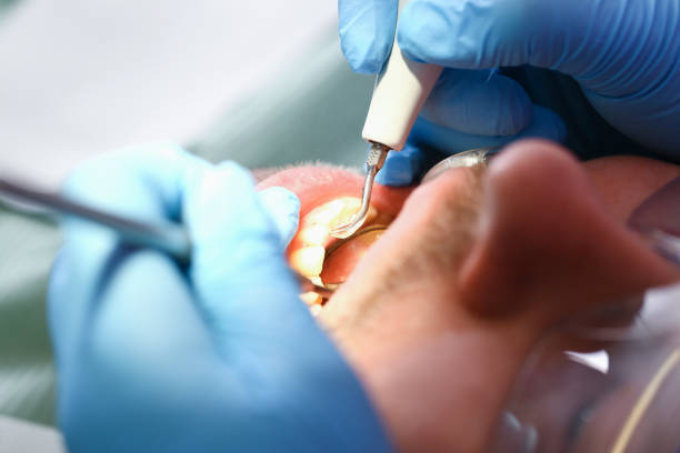 Best Emergency Care for Gum Disease in Hollins, VA